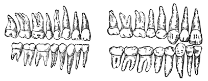 Зубные ряды гоминид